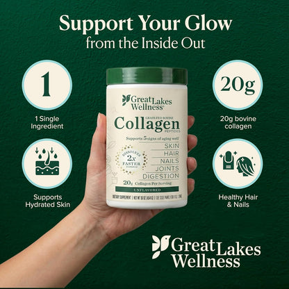 Collagen Peptides Powder – Supports Skin, Hair, Nails, Joints & Digestion – Hydrolyzed, Quick Dissolve, Non-Gmo, Keto & Kosher – Pure Collagen Protein (16 Oz, 22 Servings)